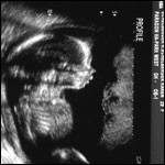 Ultra sound photo